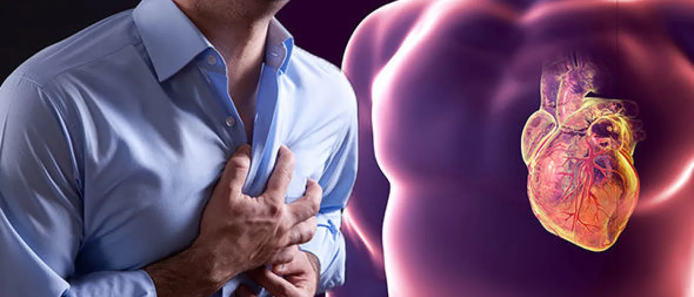Colesterol e infarto de miocardio