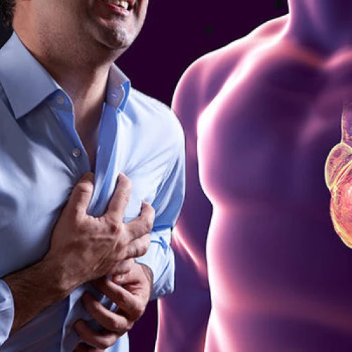 Colesterol e infarto de miocardio