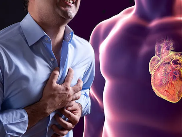 Colesterol e infarto de miocardio